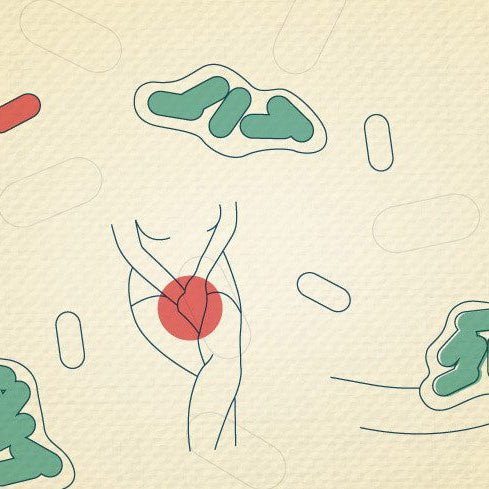 Chronic Urinary Tract Infection vs. Recurrent UTI