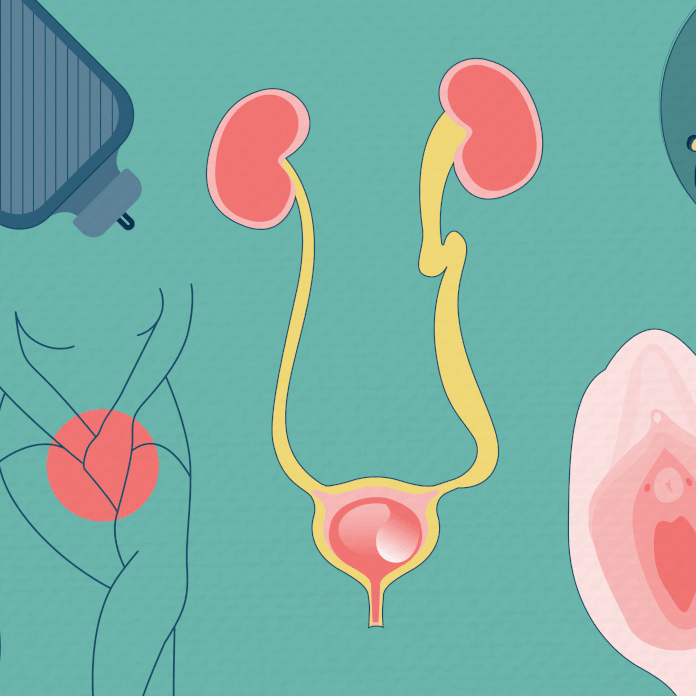 Lower Urinary Tract Symptoms: Is It Really A UTI?